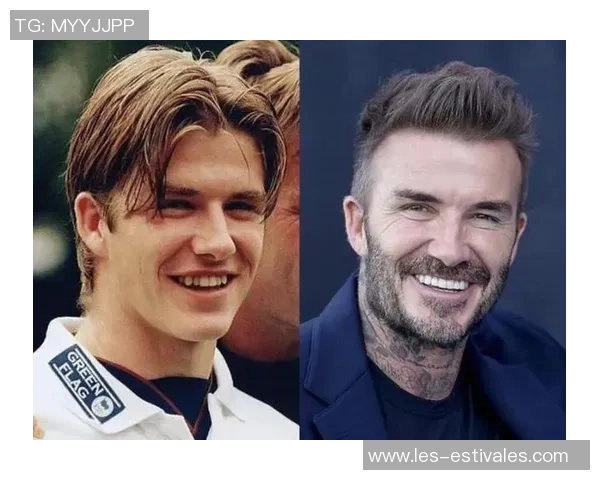 足球明星们的箍牙变身大揭秘你绝对想不到的笑容背后故事 足球明星们的箍牙变身大揭秘你绝对想不到的笑容背后故事